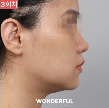 가을에 살이 더 잘빠지는 이유 3가지, 이중턱 빼는 팁 공유! 사진 13
