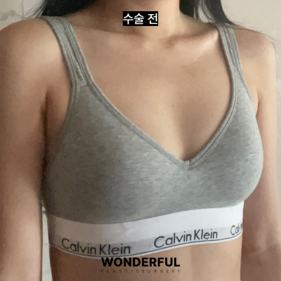 밑절 vs 겨절, 흉터 위치와 특징 완벽 비교 사진 6