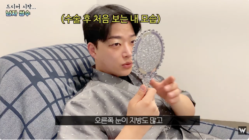 남자 무쌍성형 수술 당일부터 한달 변화 사진 6