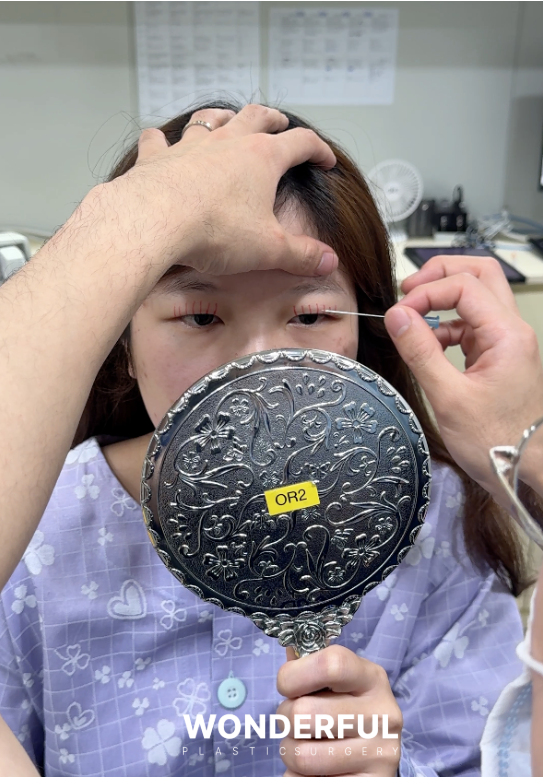 성형수술 전 최종 디자인, 왜 꼭 필요할까요? 사진 5