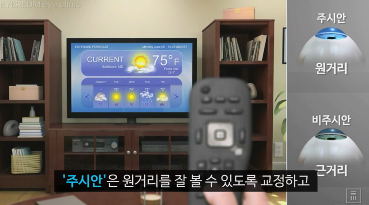 [아이리움안과 노안백내장클리닉] 노안, 언제 수술하는게 좋을까요?