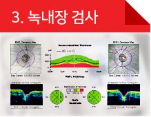 아이리움안과 만족도 높은 렌즈삽입술후기 사진 6