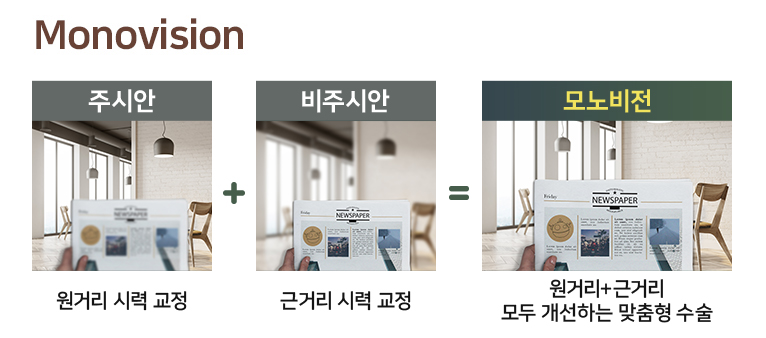 노안수술 시기에 해당될까?? 사진 6