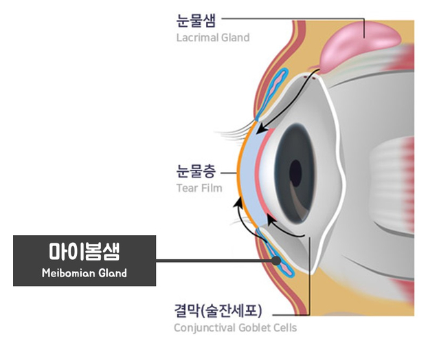 라식라섹수술 후 안구건조증 관리법: 이것만은 필수! 사진 3