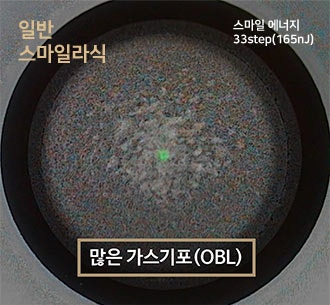 "회복 빠른 라식수술이 필요해!" -로우에너지 스마일라식을 찾는 사람들 사진 9