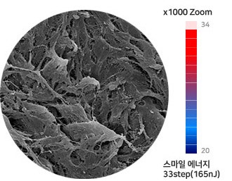 "회복 빠른 라식수술이 필요해!" -로우에너지 스마일라식을 찾는 사람들 사진 3