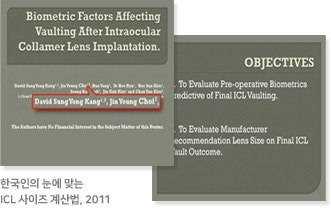 아이리움안과 렌즈삽입수술 후기 찾고 계신가요? 사진 8