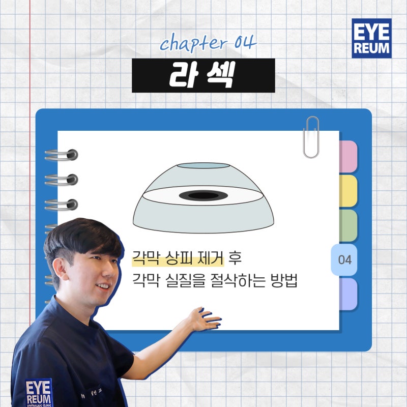라식라섹비교, 더 좋은 수술은? 사진 2