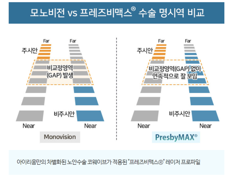 시력저하 (50대 전후편) 사진 6