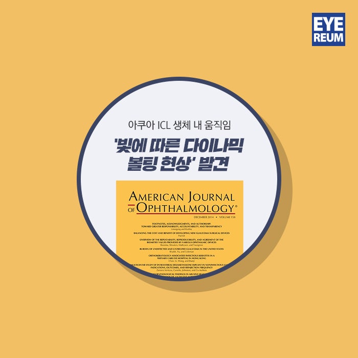렌즈삽입술 잘하는 병원, 똑똑한 선택 TiP 사진 5