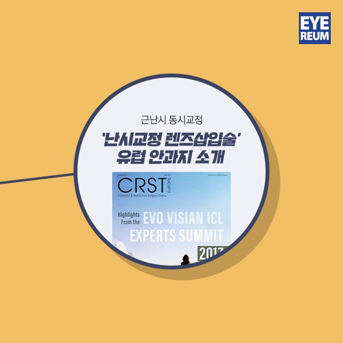 ICL수술 -렌즈삽입술 안전한 수술을 위해 사진 4