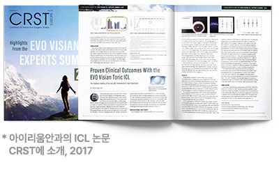 근시, 난시 교정의 ICL 렌즈삽입술, 적합한 대상은? 사진 4