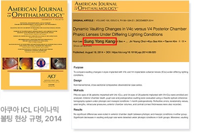 근시, 난시 교정의 ICL 렌즈삽입술, 적합한 대상은? 사진 3