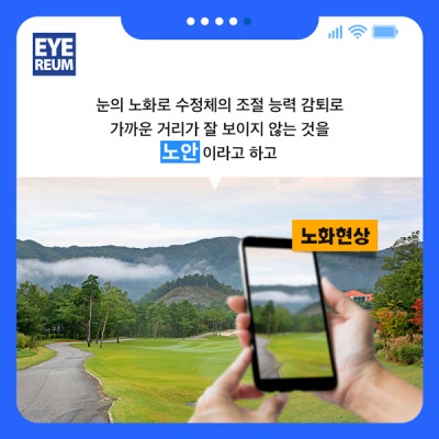 백내장수술후주의사항, 백내장 수술시기는?_강남아이리움안과 사진 2