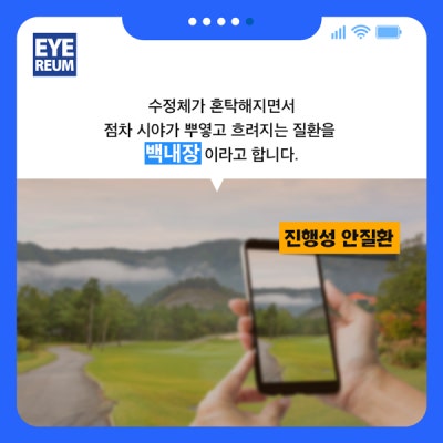 백내장수술후주의사항, 백내장 수술시기는?_강남아이리움안과 사진 3