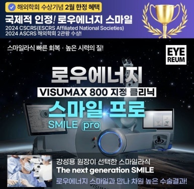 스마일라식의 또 한번의 진화, 빛번짐 해결을 위한 플라즈마스마일 이란? 사진 2