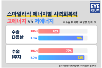 강남 라식 안과 로우에너지 스마일 사진 21