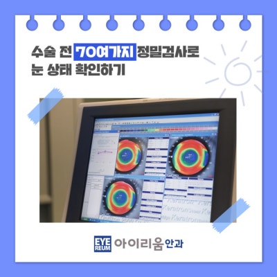 3월 3주차 내돈내산 스마일라식후기 네이버리뷰 사진 5