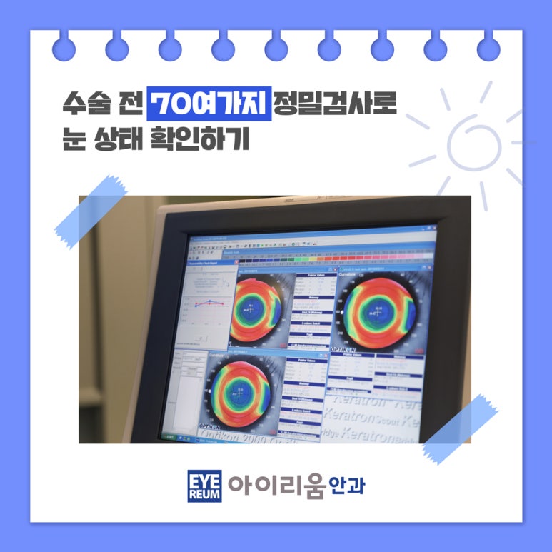 4월 1-2주차 내돈내산 스마일라식후기(+렌즈삽입술후기는덤) 사진 7