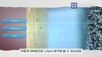 눈 건강 관리｜루테인·온열안대·눈 세정제, 제대로 알고 사용하세요 사진 13