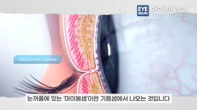 눈 건강 관리｜루테인·온열안대·눈 세정제, 제대로 알고 사용하세요 사진 12