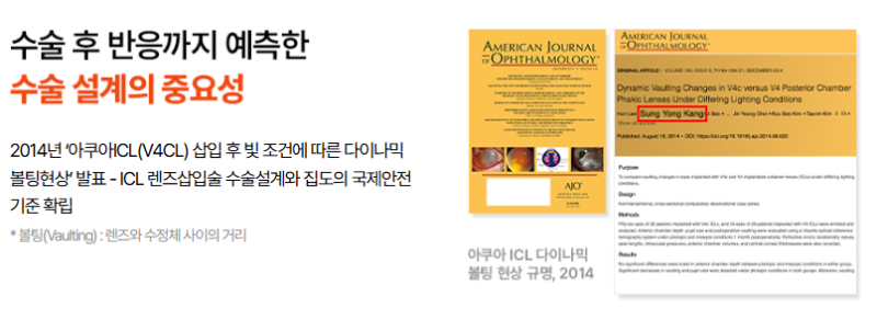 [ICL 잘하는 안과 고르는 법 1] ICL 렌즈삽입술, 검사가 중요한 이유 사진 4