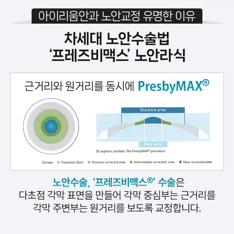 노안수술과 40대·50대 라식｜강성용 대표원장, 싱가포르 국제학회 초청 강연 사진 6