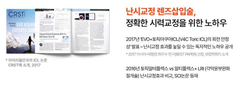 ICL 잘하는 안과 고르는 방법② -렌즈 사이즈·볼팅·토릭ICL이 중요한 이유 사진 7