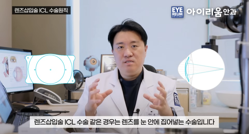 ICL 잘하는 안과 고르는 방법② -렌즈 사이즈·볼팅·토릭ICL이 중요한 이유 사진 2