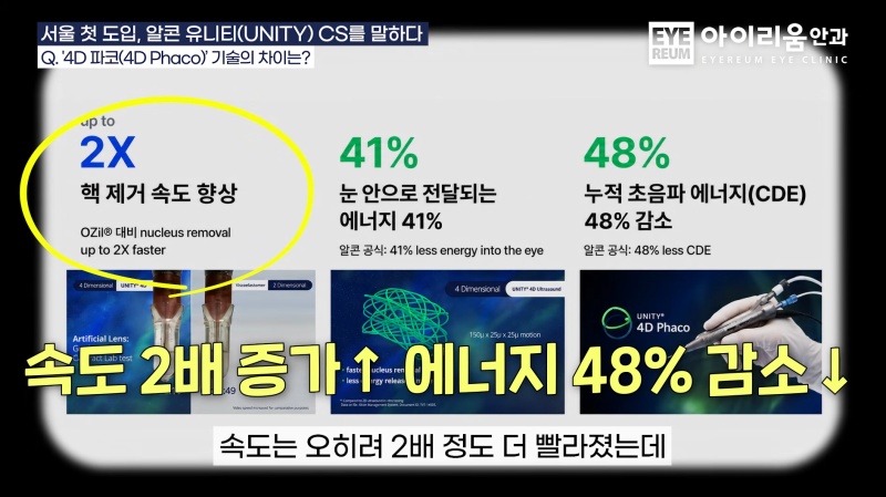 20년 전 라식했다면? 라식 1세대의 백내장수술은 달라야 합니다.