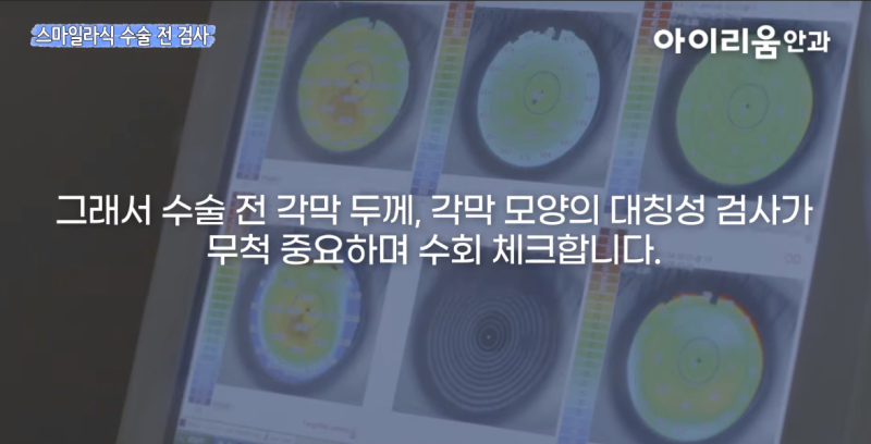 강남안과 어디로 갈까? 스마일라식·렌즈삽입술 알아보기 전 check 사진 4