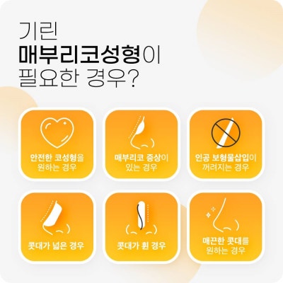 매부리코수술? 콧대만 깎는다고 해결 될까? 사진 4