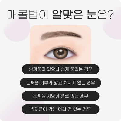 쌍수가격? 의미 없는 이유 사진 5