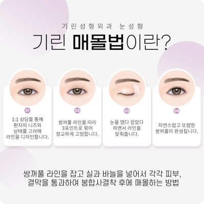 쌍수가격? 의미 없는 이유 사진 6