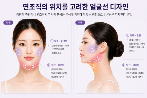 연조직윤곽술이란? 얼굴 처짐과 턱선이 고민이라면 사진 2