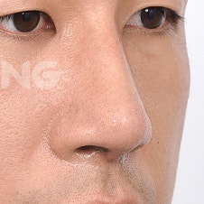 구축코재수술 전 꼭 확인해야 할 체크리스트 사진 9