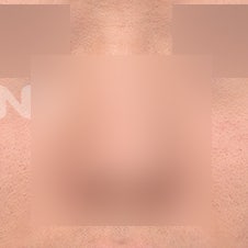 비절개코수술 vs 절개코수술, 나에게 맞는 건? 사진 2