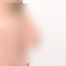 코끝성형 비용, 합리적인 가격대는 얼마? 사진 3