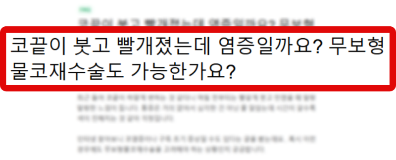 무보형물코끝수술 코끝성형 실비 환급 가능할까