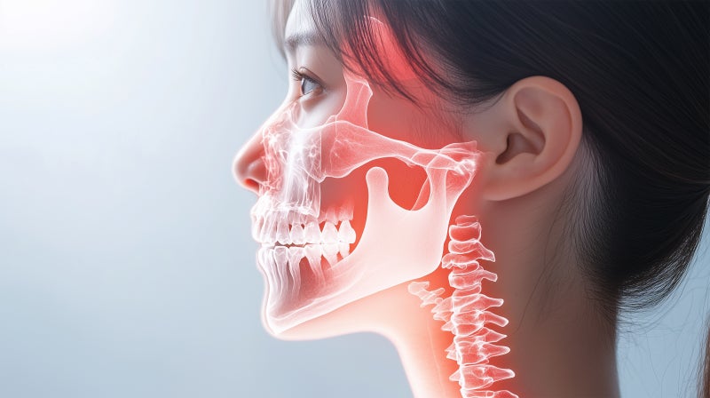 Ботокс для подтяжки линии подбородка Nefertiti Lifting в Golden Diamant Plastic Surgery!