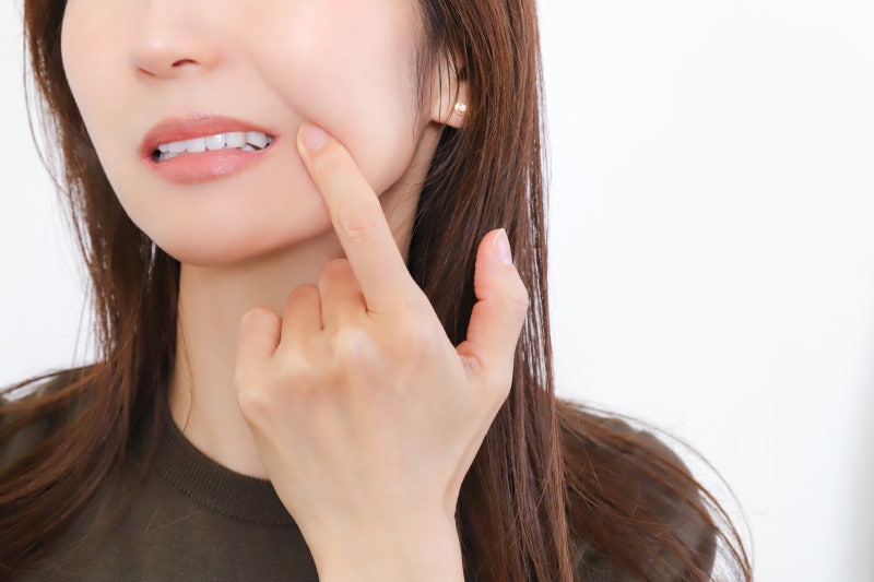 Phẫu thuật thu gọn nhân trung không sẹo Golden Diamant Tetra không sẹo