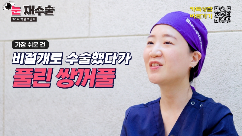 [제이준 유튜브] 눈 재수술을 막기위한 3가지 포인트! 사진 13
