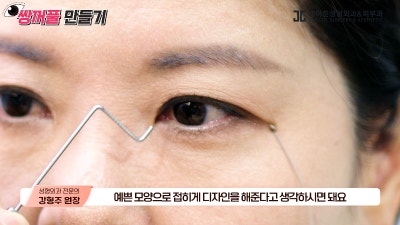 [제이준성형외과·피부과] 내 눈에 찰떡인 쌍꺼풀 라인! 미리 찾아보기👀 사진 15