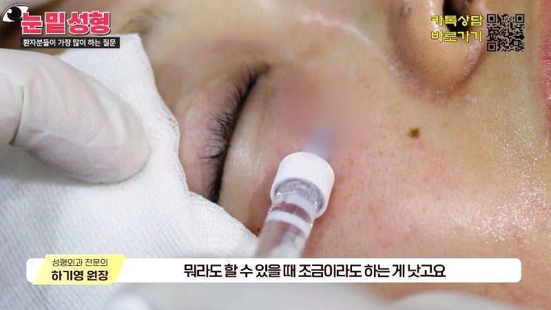 [제이준성형외과·피부과] 하안검? 눈밑지방재배치? 이것만 보고 결정하세요! 사진 37