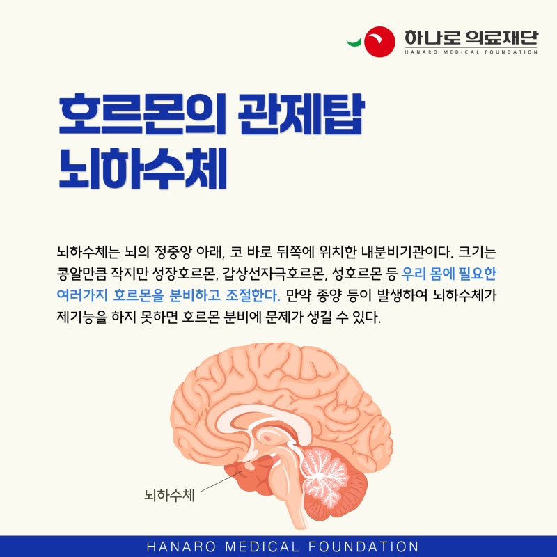라트케씨낭종, 두통의 또 다른 원인
