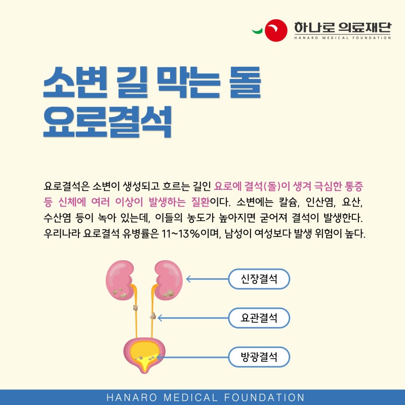강남비뇨기과 옆구리 통증과 혈뇨, 요로결석