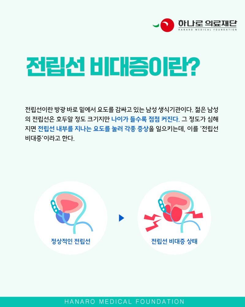 강남비뇨기과 전립선비대증 증상과 주의사항