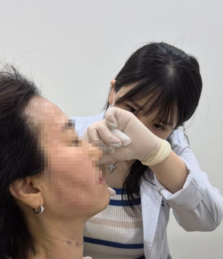 입술필러 붓기 언제 빠질까? 당일·3일·일주일 경과 사진 11