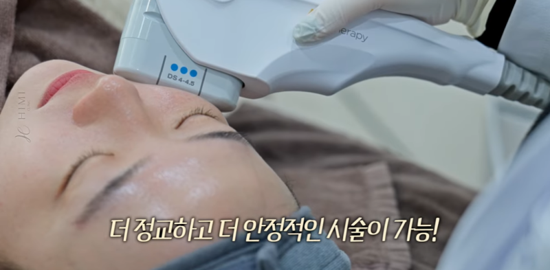 울쎄라 볼패임 걱정된다면? 얼굴살 적은 분들이 꼭 확인해야 할 것 사진 15