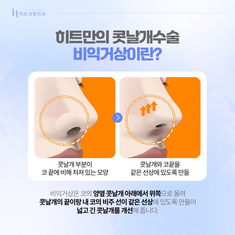 [히트성형외과] 콧볼축소의 모든 것! 비익거상과 비공내리기 사진 3